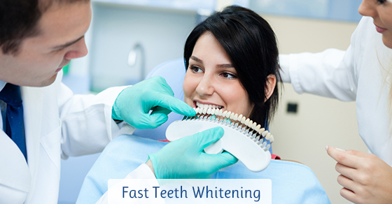 Fast Teeth Whitening