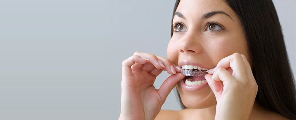 Tooth Whitening treatment Burlington